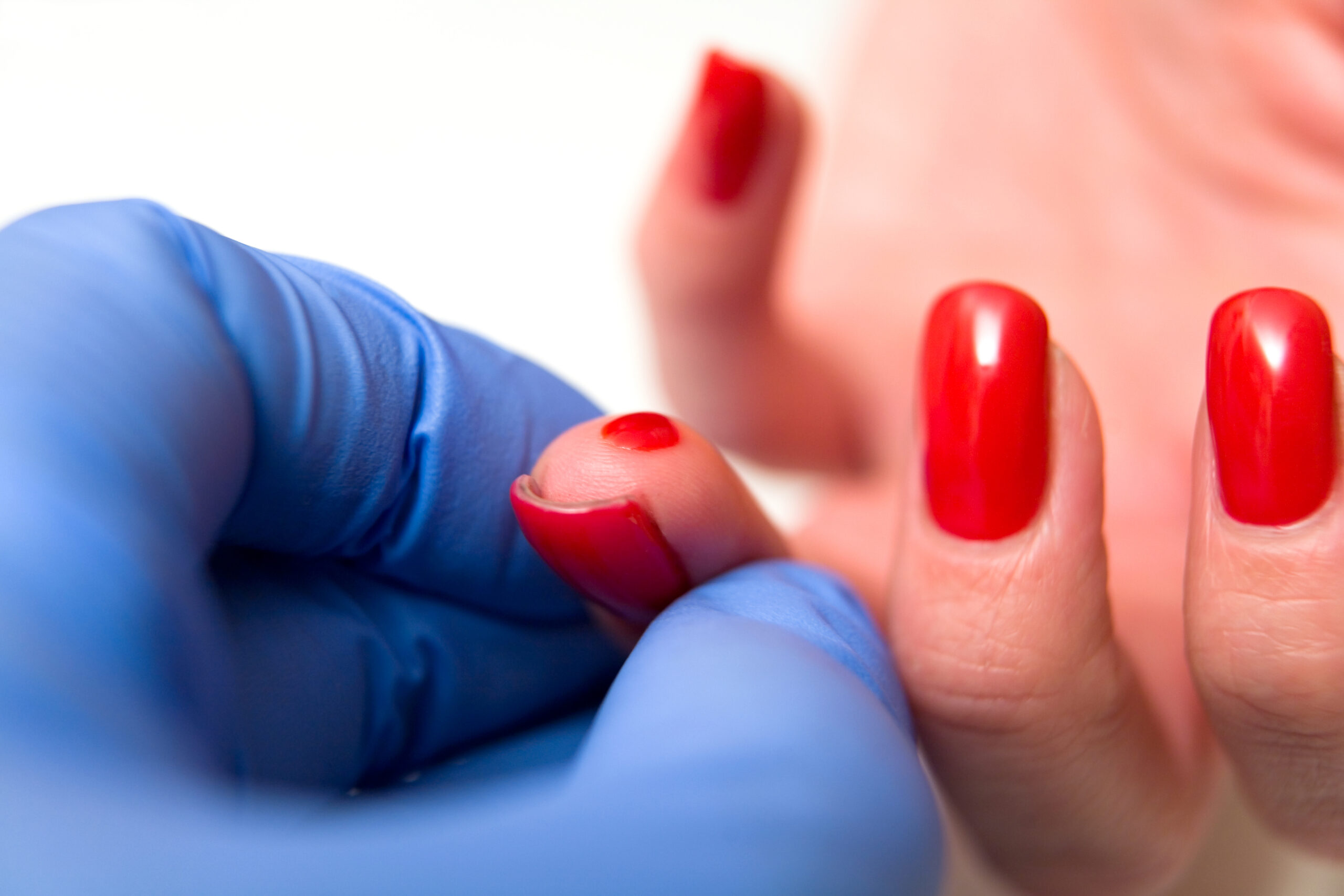 Girl,With,A,Red,Manicure,Gives,A,Blood,Test,From
